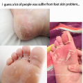 Natural extracts peeling foot mask foot peel mask